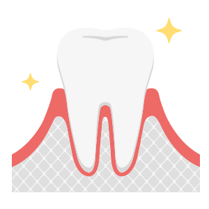 歯周病軽度